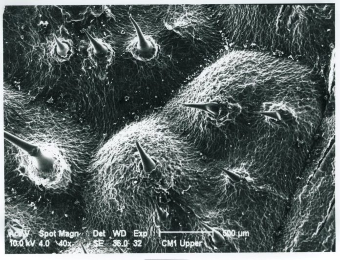Електронна мікрофотографія жалких волосків